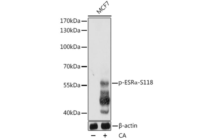 Western Blot - Anti-Estrogen Receptor alpha (phospho Ser118) Antibody (A12459) - Antibodies.com