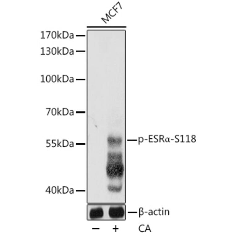 Western Blot - Anti-Estrogen Receptor alpha (phospho Ser118) Antibody (A12459) - Antibodies.com