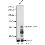 Western Blot - Anti-Estrogen Receptor alpha (phospho Ser118) Antibody (A12459) - Antibodies.com