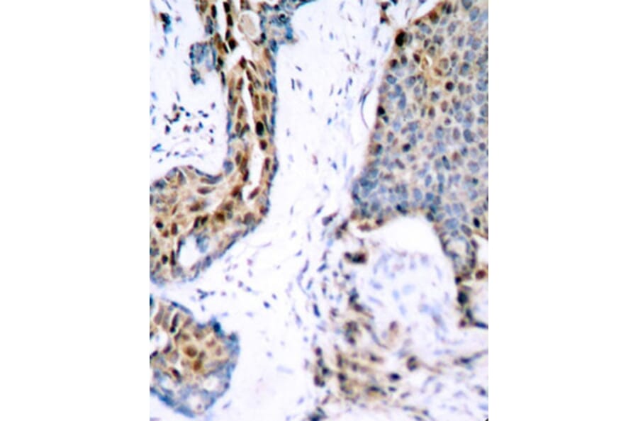 Immunohistochemistry - Anti-Estrogen Receptor alpha (phospho Ser118) Antibody (A12459) - Antibodies.com
