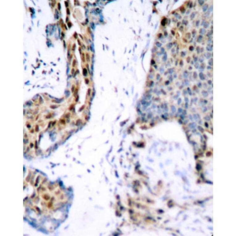 Immunohistochemistry - Anti-Estrogen Receptor alpha (phospho Ser118) Antibody (A12459) - Antibodies.com