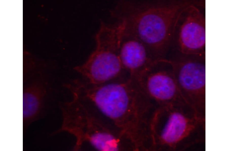Immunofluorescence - Anti-Estrogen Receptor alpha (phospho Ser118) Antibody (A12459) - Antibodies.com