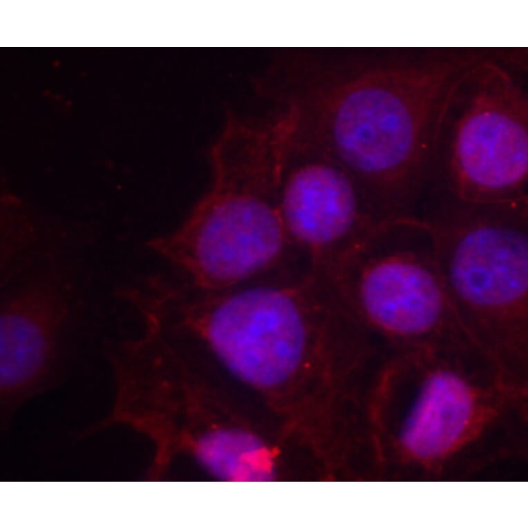 Immunofluorescence - Anti-Estrogen Receptor alpha (phospho Ser118) Antibody (A12459) - Antibodies.com