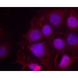 Immunofluorescence - Anti-Estrogen Receptor alpha (phospho Ser118) Antibody (A12459) - Antibodies.com