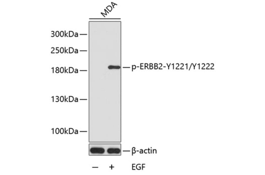 Western Blot - Anti-ERBB2 (phospho Y1221 + Y1222) Antibody (AP0149) - Antibodies.com