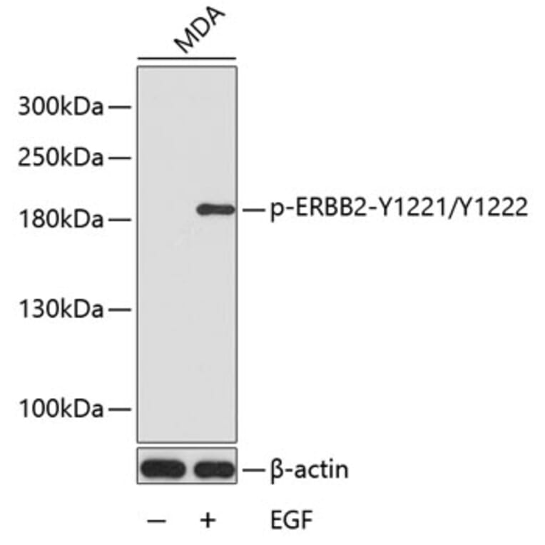 Western Blot - Anti-ERBB2 (phospho Y1221 + Y1222) Antibody (AP0149) - Antibodies.com