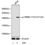 Western Blot - Anti-ERBB2 (phospho Y1221 + Y1222) Antibody (AP0149) - Antibodies.com