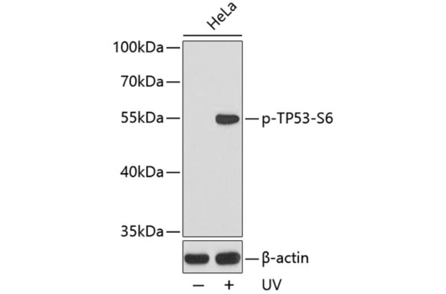 Western Blot - Anti-TP53 (phospho S6) Antibody (AP0157) - Antibodies.com