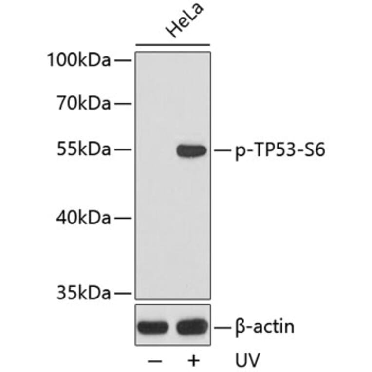 Western Blot - Anti-TP53 (phospho S6) Antibody (AP0157) - Antibodies.com