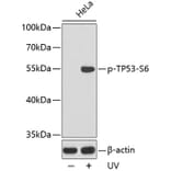 Western Blot - Anti-TP53 (phospho S6) Antibody (AP0157) - Antibodies.com