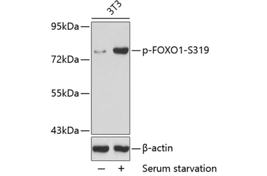 Western Blot - Anti-FOXO1 (phospho S319) Antibody (AP0176) - Antibodies.com