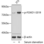 Western Blot - Anti-FOXO1 (phospho S319) Antibody (AP0176) - Antibodies.com