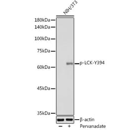 Western Blot - Anti-Lck (phospho Tyr394) Antibody (A12463) - Antibodies.com