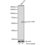 Western Blot - Anti-Lck (phospho Tyr394) Antibody (A12463) - Antibodies.com