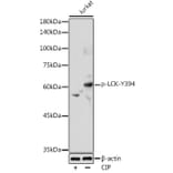 Western Blot - Anti-Lck (phospho Tyr394) Antibody (A12463) - Antibodies.com