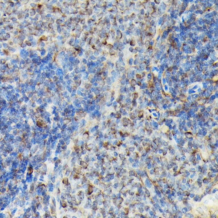 Immunohistochemistry - Anti-VASP (phospho Ser239) Antibody (A12464) - Antibodies.com