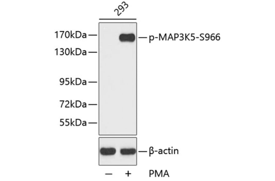 Western Blot - Anti-MAP3K5 (phospho S966) Antibody (AP0194) - Antibodies.com