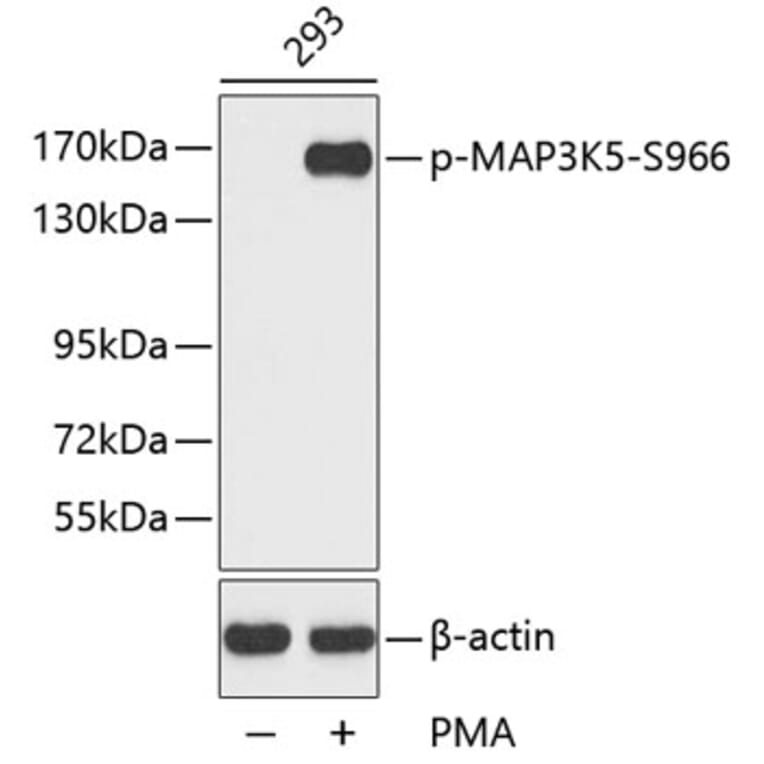Western Blot - Anti-MAP3K5 (phospho S966) Antibody (AP0194) - Antibodies.com