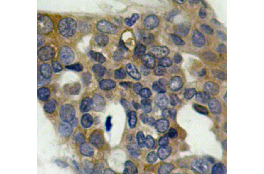 Immunohistochemistry - Anti-MAP3K5 (phospho S966) Antibody (AP0194) - Antibodies.com