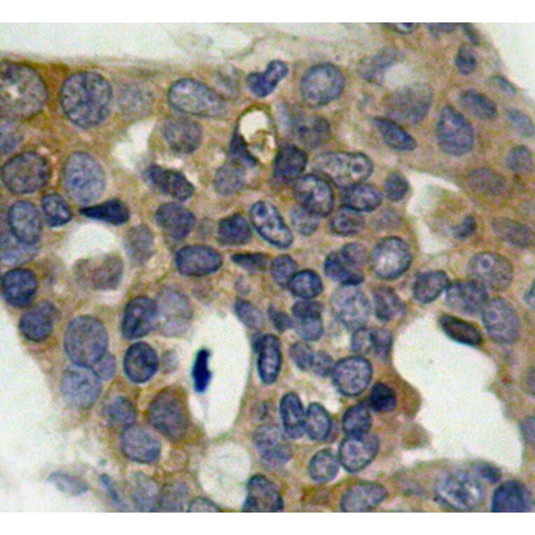 Immunohistochemistry - Anti-MAP3K5 (phospho S966) Antibody (AP0194) - Antibodies.com