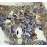 Immunohistochemistry - Anti-MAP3K5 (phospho S966) Antibody (AP0194) - Antibodies.com