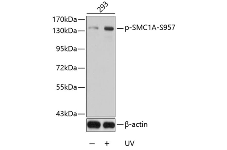 Western Blot - Anti-SMC1A (phospho S957) Antibody (AP0204) - Antibodies.com