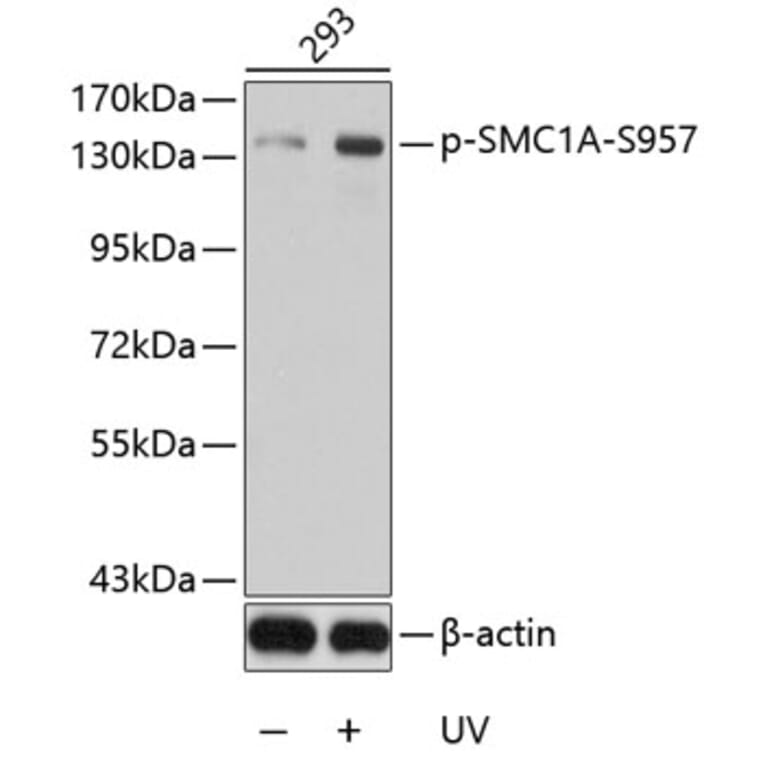 Western Blot - Anti-SMC1A (phospho S957) Antibody (AP0204) - Antibodies.com