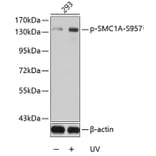 Western Blot - Anti-SMC1A (phospho S957) Antibody (AP0204) - Antibodies.com