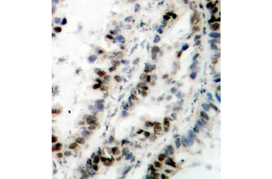 Immunohistochemistry - Anti-SMC1A (phospho S957) Antibody (AP0204) - Antibodies.com