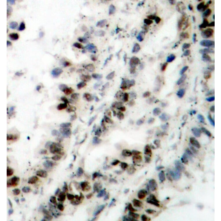 Immunohistochemistry - Anti-SMC1A (phospho S957) Antibody (AP0204) - Antibodies.com