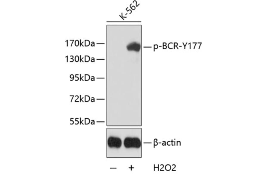 Western Blot - Anti-BCR (phospho Y177) Antibody (AP0205) - Antibodies.com