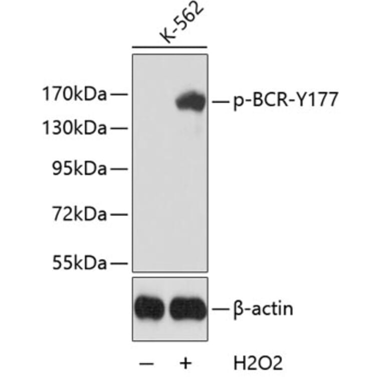 Western Blot - Anti-BCR (phospho Y177) Antibody (AP0205) - Antibodies.com