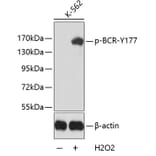 Western Blot - Anti-BCR (phospho Y177) Antibody (AP0205) - Antibodies.com