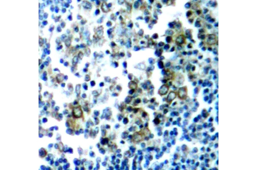 Immunohistochemistry - Anti-BCR (phospho Y177) Antibody (AP0205) - Antibodies.com