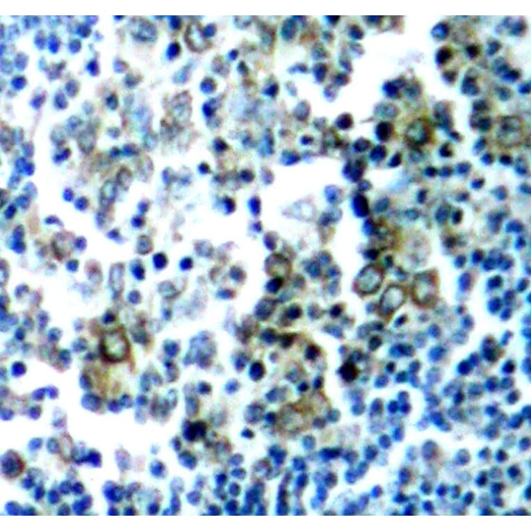 Immunohistochemistry - Anti-BCR (phospho Y177) Antibody (AP0205) - Antibodies.com