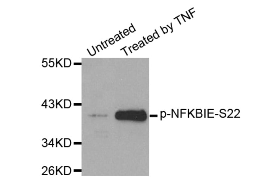 Western Blot - Anti-NFKBIE (phospho S22) Antibody (AP0212) - Antibodies.com