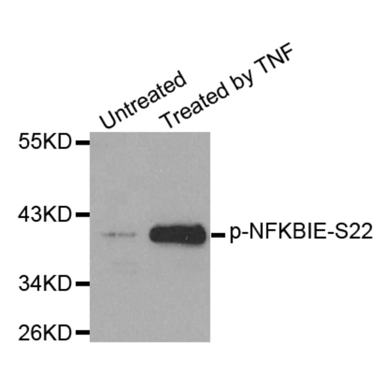Western Blot - Anti-NFKBIE (phospho S22) Antibody (AP0212) - Antibodies.com
