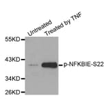 Western Blot - Anti-NFKBIE (phospho S22) Antibody (AP0212) - Antibodies.com