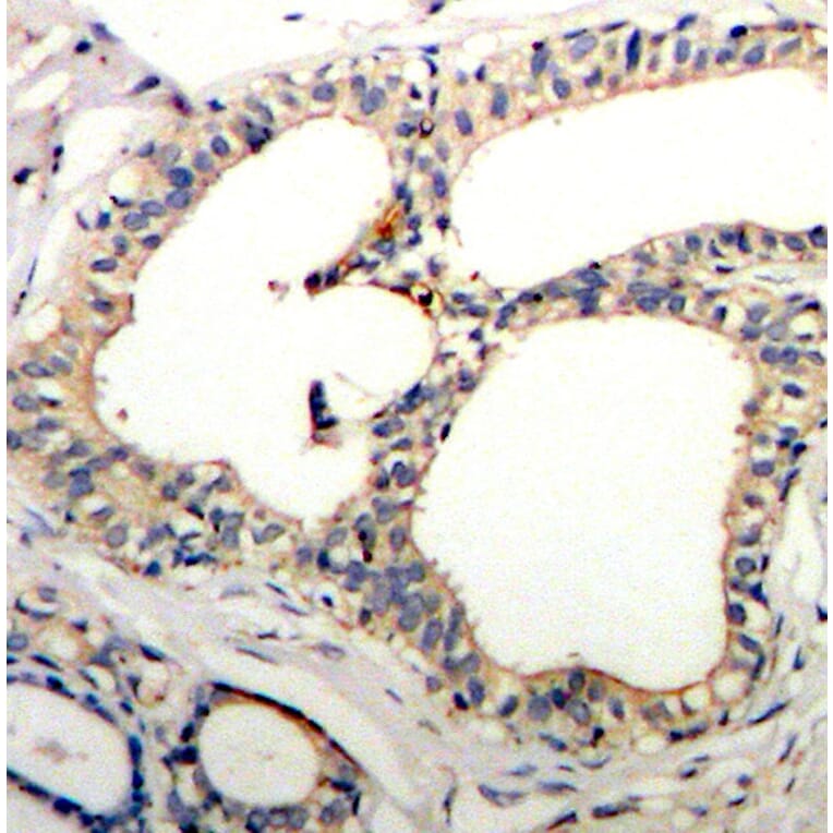Immunohistochemistry - Anti-NFKBIE (phospho S22) Antibody (AP0212) - Antibodies.com