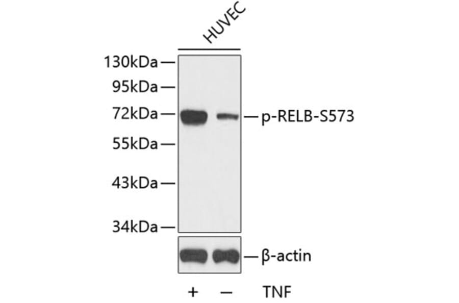 Western Blot - Anti-RELB (phospho S573) Antibody (AP0240) - Antibodies.com