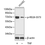 Western Blot - Anti-RELB (phospho S573) Antibody (AP0240) - Antibodies.com