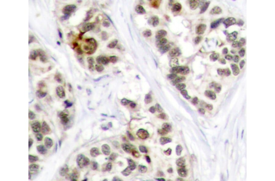 Immunohistochemistry - Anti-RELB (phospho S573) Antibody (AP0240) - Antibodies.com