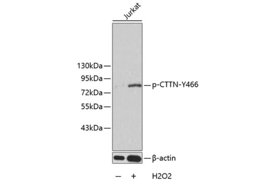 Western Blot - Anti-CTTN (phospho Y466) Antibody (AP0247) - Antibodies.com