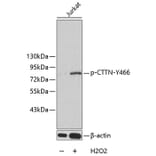 Western Blot - Anti-CTTN (phospho Y466) Antibody (AP0247) - Antibodies.com
