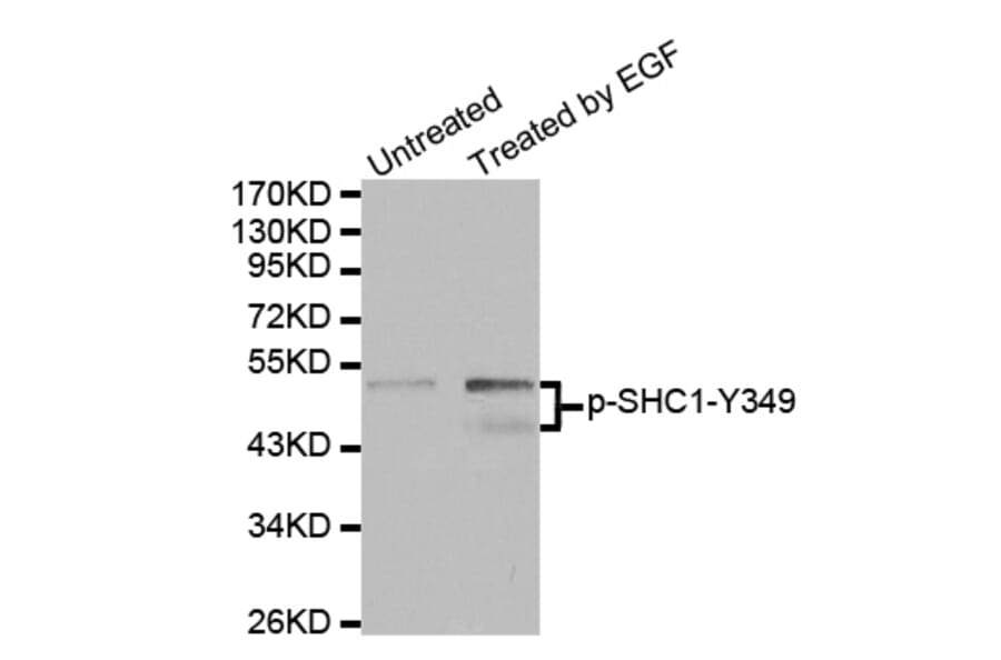 Western Blot - Anti-SHC1 (phospho Y349) Antibody (AP0265) - Antibodies.com