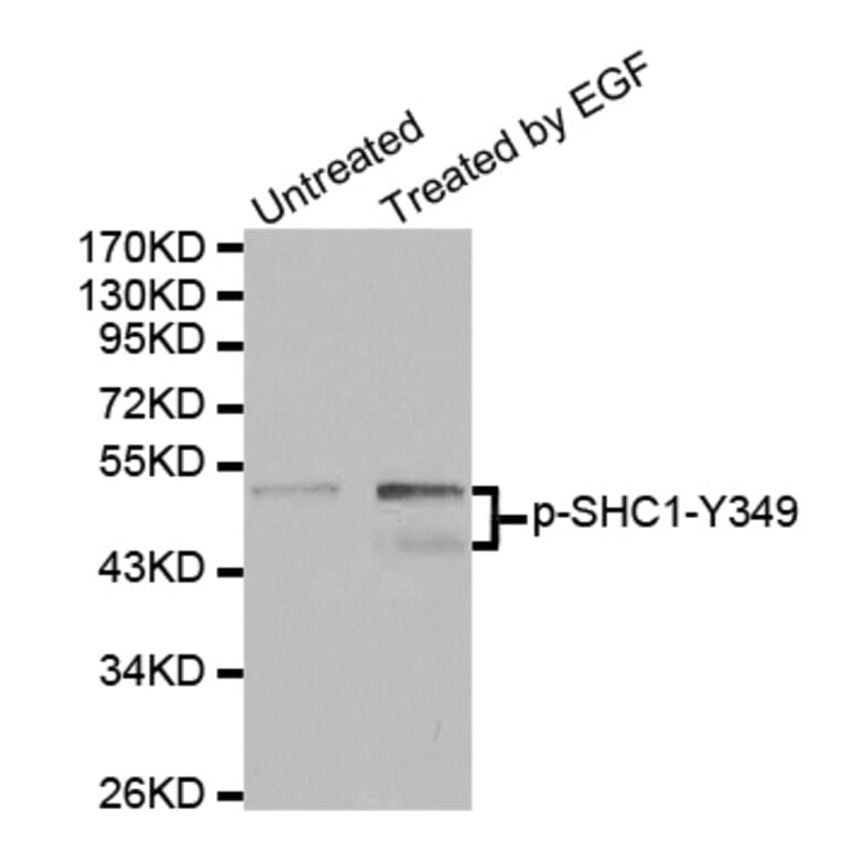 Western Blot - Anti-SHC1 (phospho Y349) Antibody (AP0265) - Antibodies.com