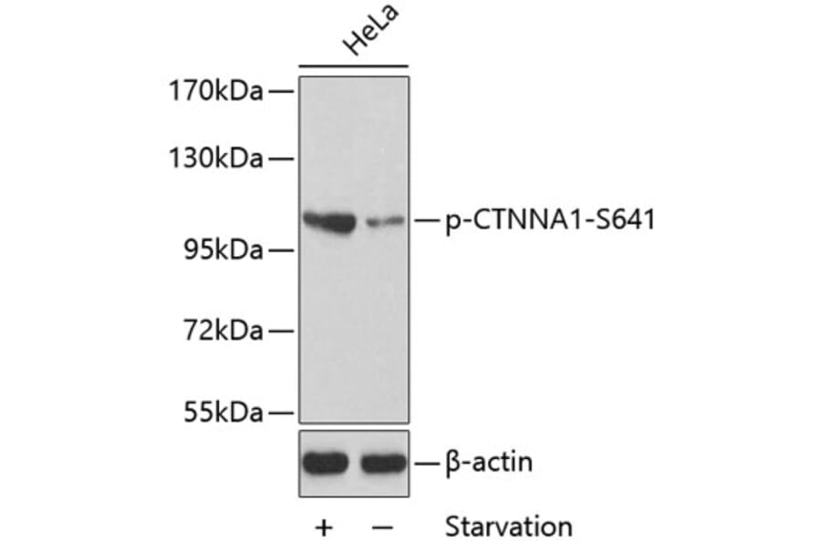 Western Blot - Anti-CTNNA1 (phospho S641) Antibody (AP0273) - Antibodies.com