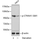 Western Blot - Anti-CTNNA1 (phospho S641) Antibody (AP0273) - Antibodies.com