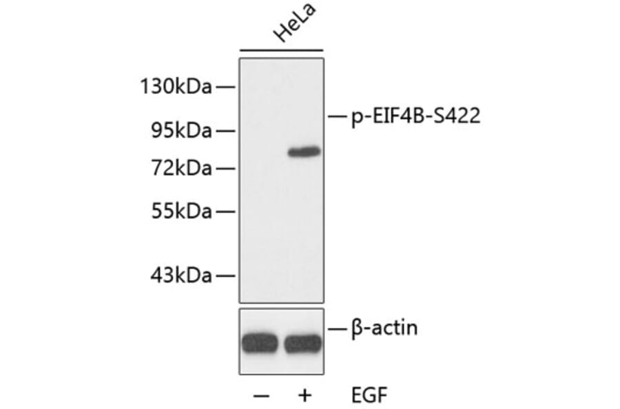 Western Blot - Anti-EIF4B (phospho S422) Antibody (AP0278) - Antibodies.com