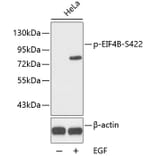 Western Blot - Anti-EIF4B (phospho S422) Antibody (AP0278) - Antibodies.com